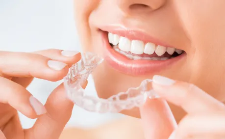 Invisalign®